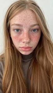 Today someone made fun of me because of my freckles... again I think I'll  just stay in my bed all day.