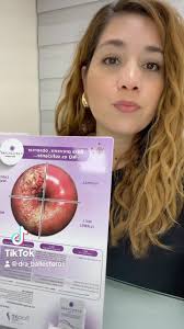 ¿Cómo saber si tengo vph de alto riesgo? 🦠 🔬 , #vph #colposcopia  #lesionesprecancerosas #cancer #ginecologia #oncologiaginecologica #cervix  #pcr