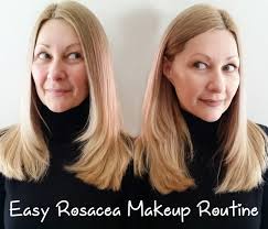 rosacea makeup tutorial with it