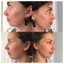 TOP 10 BEST Aestheticians near Joseph, OR