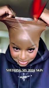 Girl's Bald Head Itch Leads to Surprising Results