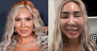 Teen Mom' alum Farrah Abraham blasts Texas med spa