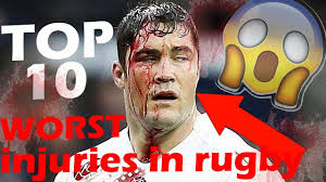 The problem also affects thousands of young people who engage in a variety of sports. Top 10 Horrific Rugby Injuries Brakes Dislocations Youtube