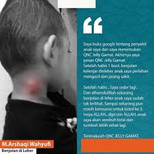 Anda patut periksa kerana ia mungkin hanya goitre, tiroid besar tetapi normal atau ia mungkin adalah kelenjar. Obat Benjolan Benjolan Di Leher Payudara Ketiak Tangan Menghilangkan Benjolan Lipoma Qnc Ori Shopee Indonesia