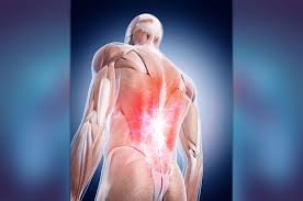 The latissimus dorsi (/ləˈtɪsɪməs ˈdɔːrsaɪ/) is a large, flat muscle on the back that stretches to the sides, behind the arm, and is partly covered by the trapezius on the back near the midline. Latissimus Dorsi Pain Action Plan Everything You Need To Know