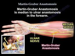 An anastomosis (plural anastomoses) is a connection or opening between two things (especially cavities or passages) that are normally diverging or branching, such as between blood vessels, leaf veins, or streams. Martin Gruber Anastomosis Everything You Need To Know Dr Nabil Ebraheim Youtube