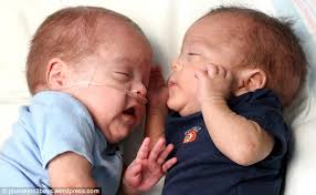 Medical miracle as twin boys weighing just a pound a half are born from two  uteruses