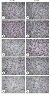 In 1992, mark murray asked kent duren to create some abstract videos to use in. Figure 1 From Reproduction Related Effects Of Green Alga Coccomyxa Sp Infestation In The Horse Mussel Modiolus Modiolus Semantic Scholar