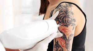 This absorption of energy would result in rapid heating of the tattooed area. How Laser Hair Removal Affects Tattoos Fresh Skin Canvas