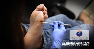 Elevated blood glucose levels narrow the body's blood vessels and stiffen its arteries. Diabetic Foot Care Oc Feet