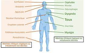 Mal de tête, migraine, état grippal, fièvre, mal de ventre, douleur de règles, mal de dents, courbature, crampe, entorse, douleur de l'accouchement douleurs chroniques tendinite, douleur articulaire (arthrose), douleur osseuse (fracture), mal de dos, douleur suite à un accident ou une opération douleurs liées à des maladies douloureuses Symptomes Du Covid 19 Variant Premiers Duree Que Faire