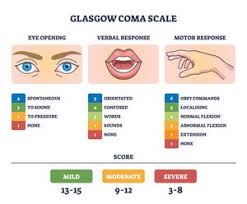 Image result for Concussion Grading