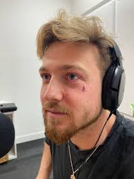 Sam thompson is a reporter at cjob.com. S1 Ep 1 Sam Thompson Pete Wicks Just A Little Prick