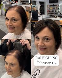 You can see the moment she lights up 🥰 #hairtopper #hairmakeover  #hairlosssolution #womenhairloss #thinninghairsolution