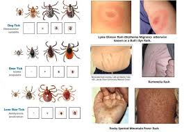 Ba7a90259d4f9e35b64bdb88becebfb1 Jpg 736 530 Tick Rash Lyme Disease Ticks