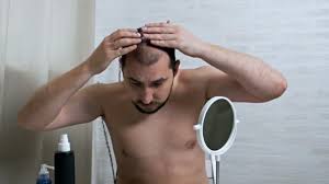 Share to facebook share to twitter email. Fight Against Hair Loss In Men Shots To The Head Treatment Of Male Pattern Baldness Early Hair Loss A Man Uses A Cream Hair Growth