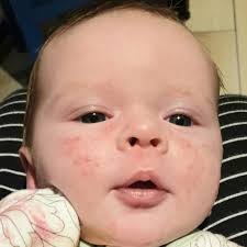 BABIES: Gorgeous Mackay babies