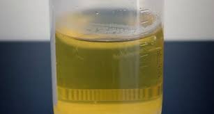 Dog mouthwash is specially formulated for dogs so that it is safe to ingest. From Gunpowder To Teeth Whitener The Science Behind Historic Uses Of Urine Science Smithsonian Magazine