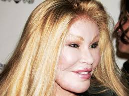 Such plastic surgery nightmares can destroy a celebrity's career in showbiz. Celebrity Plastic Surgery Disasters Cbs News