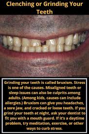 If you know you have this. Clenching Or Grinding Your Teeth Sore Jaw Misaligned Teeth Bruxism
