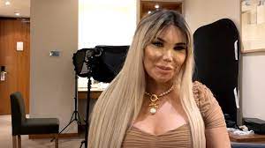 Has jessica alves reached her final form? Jessica Alves Before And After 5 Months After Her Facial Feminization Surgery Youtube
