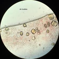Pin On Nephro Pics