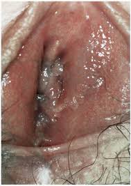 Download in under 30 seconds. Papillae Plastic Surgery Key