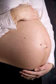 Melasma How Pregnancy Impacts Facial Melanin Coco Ruby Skin