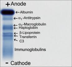Serum Proteins Images Medical Laboratory Scientist Medical Technology Medical Laboratory