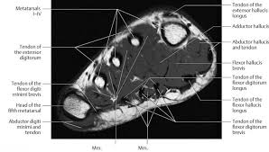 Routine ankle magnetic resonance imaging (mri) tests involve taking images of the foot the mri machine uses radio wave energy pulses and a magnetic field to produce the foot and ankle images. Ankle And Foot Radiology Key