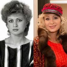 Белла хадид до и после пластики фото. Kak Vyglyadit Pevica Shansona Vika Cyganova Do I Posle Plastiki