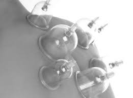 Cupping therapy is the secret to michael phelps recovery and gwyneth's detox routine. Cupping Therapy South Jersey Sports Acupuncture In Marlton Nj