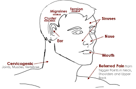 Diagram Of Head Pain Headache Location Chart Meaning