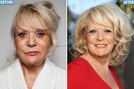 Sherrie hewson has revealed she 'can't stop crying' after her brother's sudden death from brain cancer. 100 Years Younger Stars Claire King Sid Owen And Sherrie Hewson Reveal Dramatic Transformations After Shedding Years In Just 21 Days