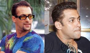 Salman Khans Hair Transplant His Hair Clinic How did he manage to overcome this problem?