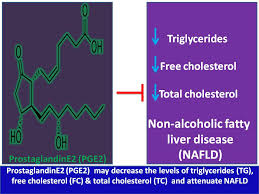 Steroid Based Therapy For Non Alcoholic Fatty Liver Disease Nafld Prostaglandin Pge2 Promotes Degradation Of Hmgcr Decreases The Levels Of Triglycerides Free Cholesterol And Total Cholesterol And Prevents The Progression Of Non Alcoholic Fatty