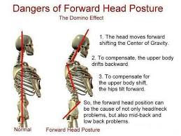 If the appendix becomes inflamed, starts leaking or ruptures, it may cause symptoms that include lower right back pain. Category Dr Eve Choe Toronto Chiropractor Posture Expert