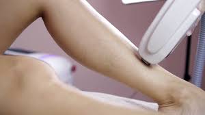 About 1% % of these are home use ipl machine, 1%% are epilator. Laser Hair Removal On Ladies Legs The Girl Is Lying On The Couch In The Medical Glasses In The Treatment Room The Hands Of The Cosmetologist Make The Epilation Of The Legs