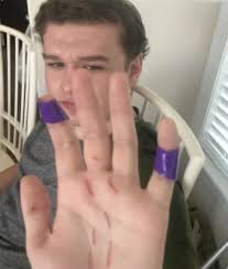 Teen sustains 40 puncture wounds after shark attack in North Carolina