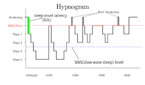 Check spelling or type a new query. Rapid Eye Movement Sleep Wikipedia