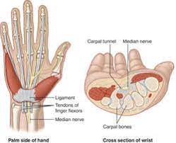 It is characterized by both sensory disturbances (pain, tingling, and numbness) and motor symptoms (weakness and clumsiness of the thumb) in the. Carpal Tunnel Definition Of Carpal Tunnel By Medical Dictionary