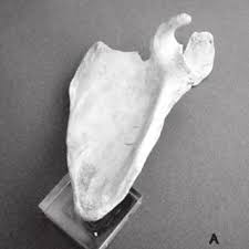 For this reason, fungi are also classified according to their morphologies. Classification Of The Acromial Morphology According To Bigliani Et Al Download Scientific Diagram