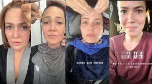 Silver landings out now ❤️ mandymoore.lnk.to/silverlandings. See Mandy Moore Remove Her This Is Us Face Prosthetics Purewow