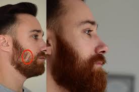 So eine frisur hat man ja nicht ewig. 10 Tipps Was Du Gegen Lucken Im Bart Tun Kannst