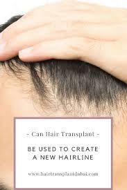 Hair Fall Is A Concern To Many People These Days Most Of The People Like To See In The Mirror And Admire Their Beauty Hair Transplant Help Hair Loss Fall Hair