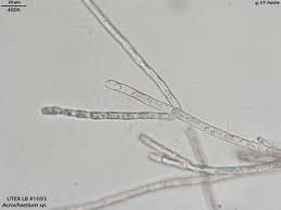 Image result for Acritochaete volkensii