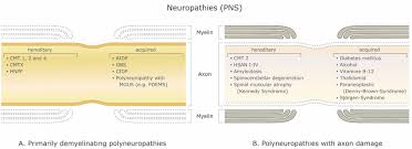 In pns, eve splits off a single photon or a small number of photons from each bit transmission for measurement and allows the rest to pass on to bob. Demyelinating Disorders Of The Peripheral Nervous System Pns A Download Scientific Diagram