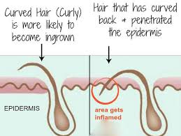 The labia majora can range in width from one fourth of an. Ingrown Hair On Vagina Labia Pictures Bump Symptoms Prevention
