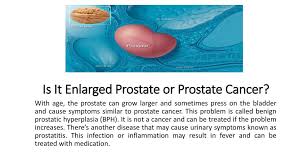Whether you or someone you love has cancer, knowing what to expect can help you cope. What Is Prostate Cancer Ppt Download