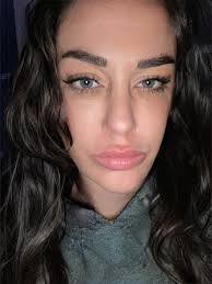 Can a photo's lip features be enhanced?